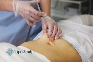 Does Skin Sag After Fat Dissolving Injections? 2 Do you want to get Aqualyx fat dissolving injections Little Bognor but worried about loose skin afterwards?