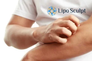 Best Actinic Keratoses Removal 4 prevent your actinic keratoses Little Bognor getting worse - call our team today!