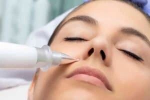 Best Actinic Keratoses Removal 3 Actinic keratoses Little Bognor solutions - book in today!